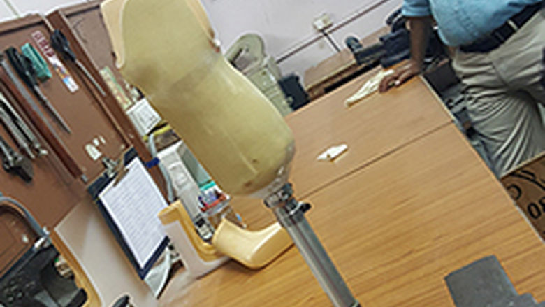 Instructor in India w a prosthesis