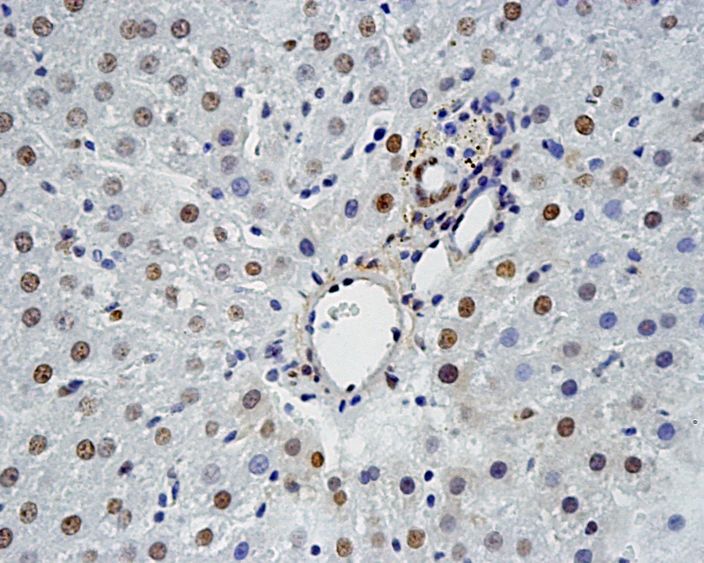 Bloomer: Aging impairs induction of redox factor-1 after heat stress